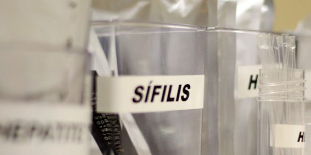 centro-de-sp-tem-testagem-gratis-de-hiv,-hepatite,-siflis-e-gonorreia