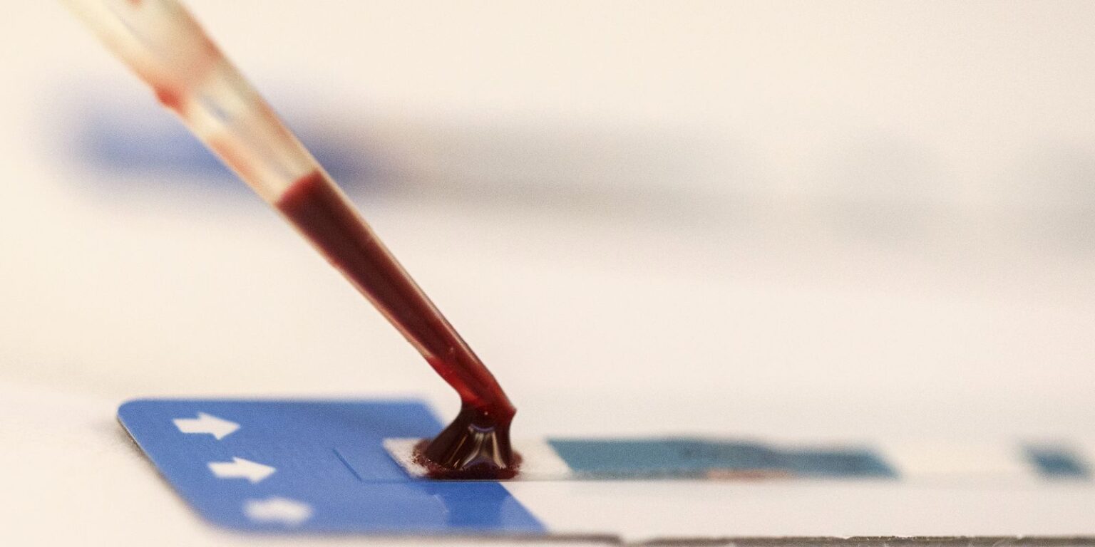 Estudo inédito da Fiocruz pode ampliar prevenção de HIV entre jovens estudo-inedito-da-fiocruz-pode-ampliar-prevencao-de-hiv-entre-jovens