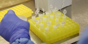 SP confirma segundo caso importado de sarampo sp-confirma-segundo-caso-importado-de-sarampo