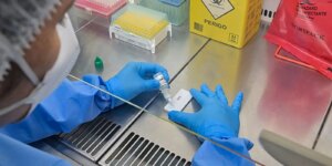 Minas Gerais confirma primeira morte por hantavírus em 2026 minas-gerais-confirma-primeira-morte-por-hantavirus-em-2026