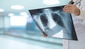 comissao-de-saude-debate-incorporacao-da-terapia-tripla-para-tratamento-da-fibrose-cistica