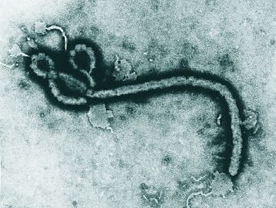 sao-paulo-investiga-caso-suspeito-de-ebola-em-homem-de-37-anos
